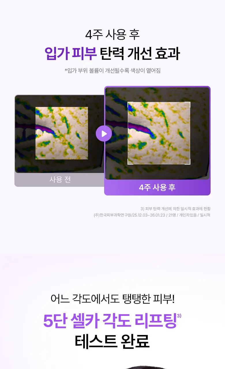 [카디비PICK|탄력보습] 바이오힐보 프로바이오덤 3D리프팅 크림 50ml [단품/기획] 상세페이지 17